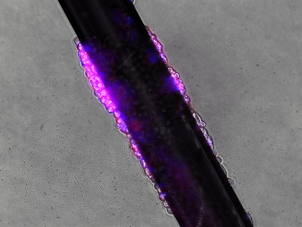 Ánh sáng cho sự sống: Một lab-on-fiber được dùng để phát hiện sự phát triển của các tế bào ung thư da [màu tím]. Hình được chụp bằng một kính hiển vi huỳnh quang. Hình: Yanina Shevchenko và Gulden Camci-Unal, Harvard University.